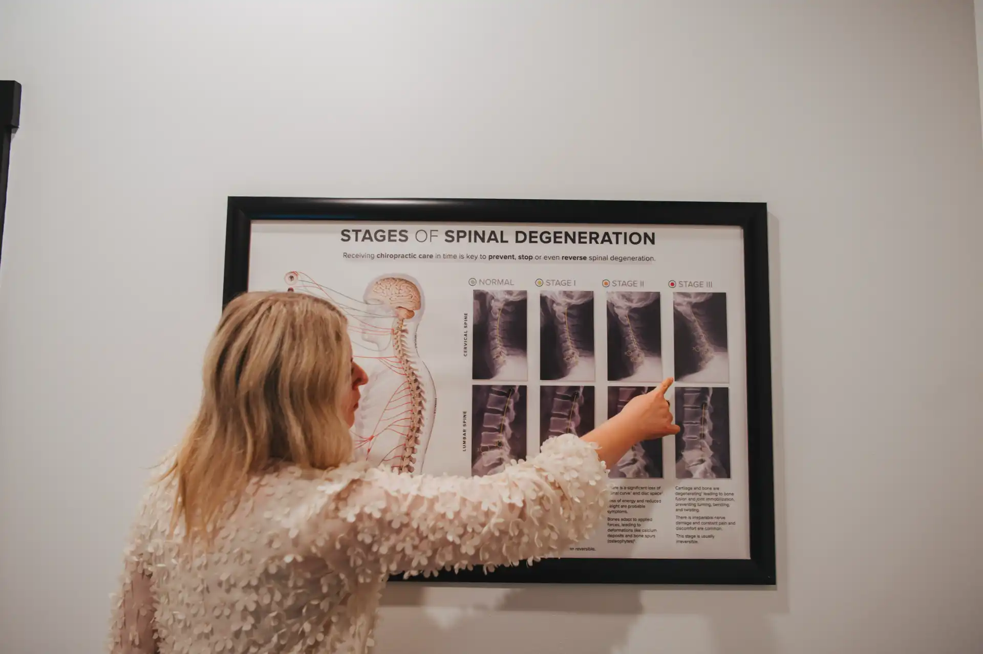 Dr. Mariah reviewing stages of spinal degeneration with a practice member