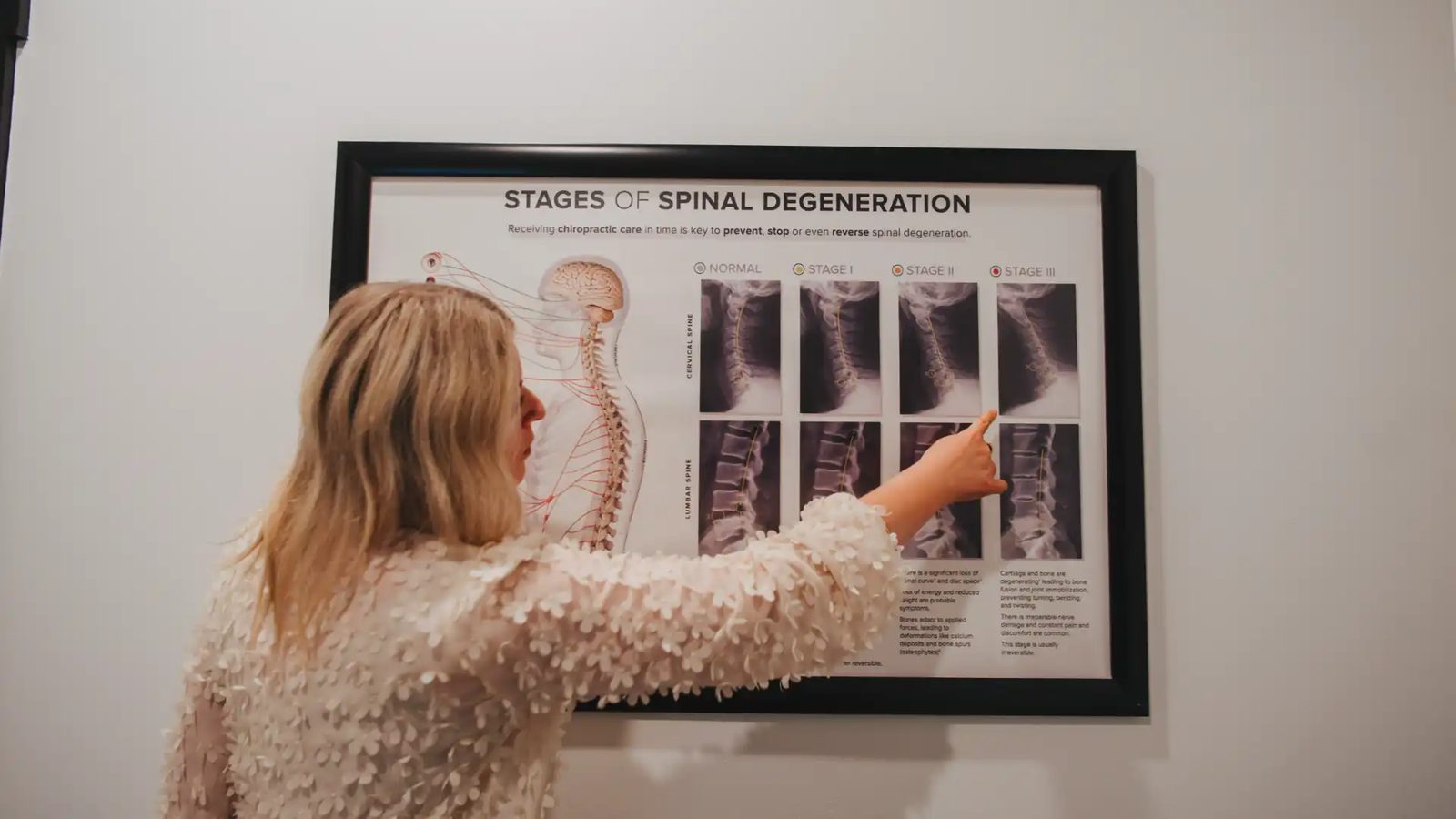 What Does a Chiropractor Do?